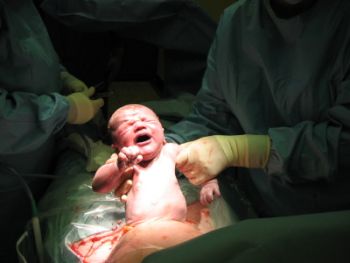 lindja-me-operacion-nena-dhe-femija